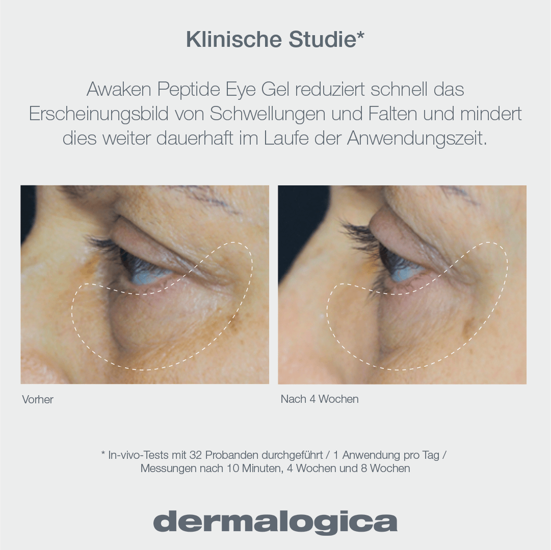 Dermalogica Awaken Peptide Eye Gel – Augenpflege