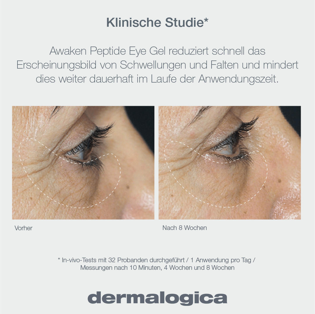 Dermalogica Awaken Peptide Eye Gel – Augenpflege