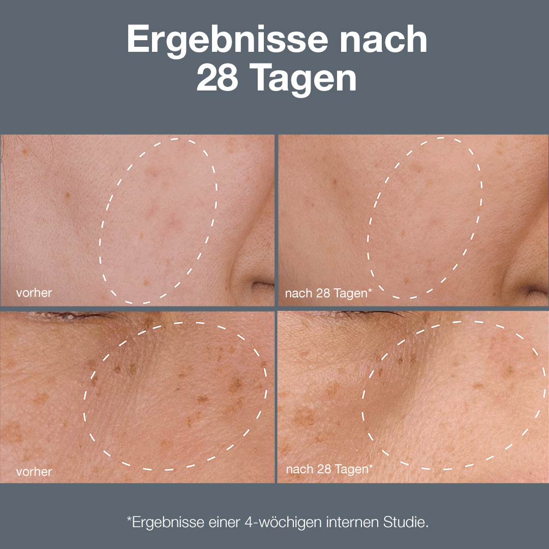 Dermalogica Powerbright Dark Spot System – Pflegeset