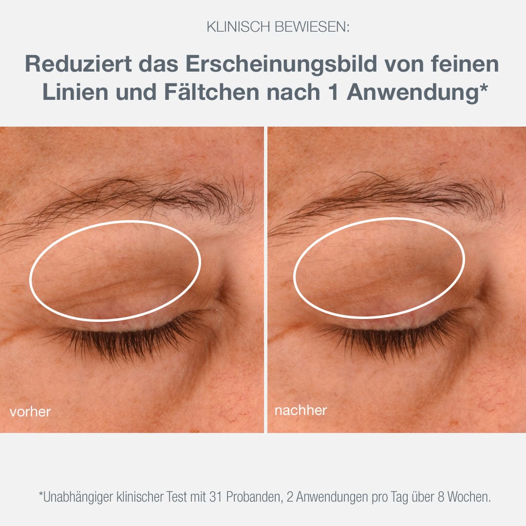 Dermalogica Phyto Nature e² Treatment + Lifting Eye Cream – Set