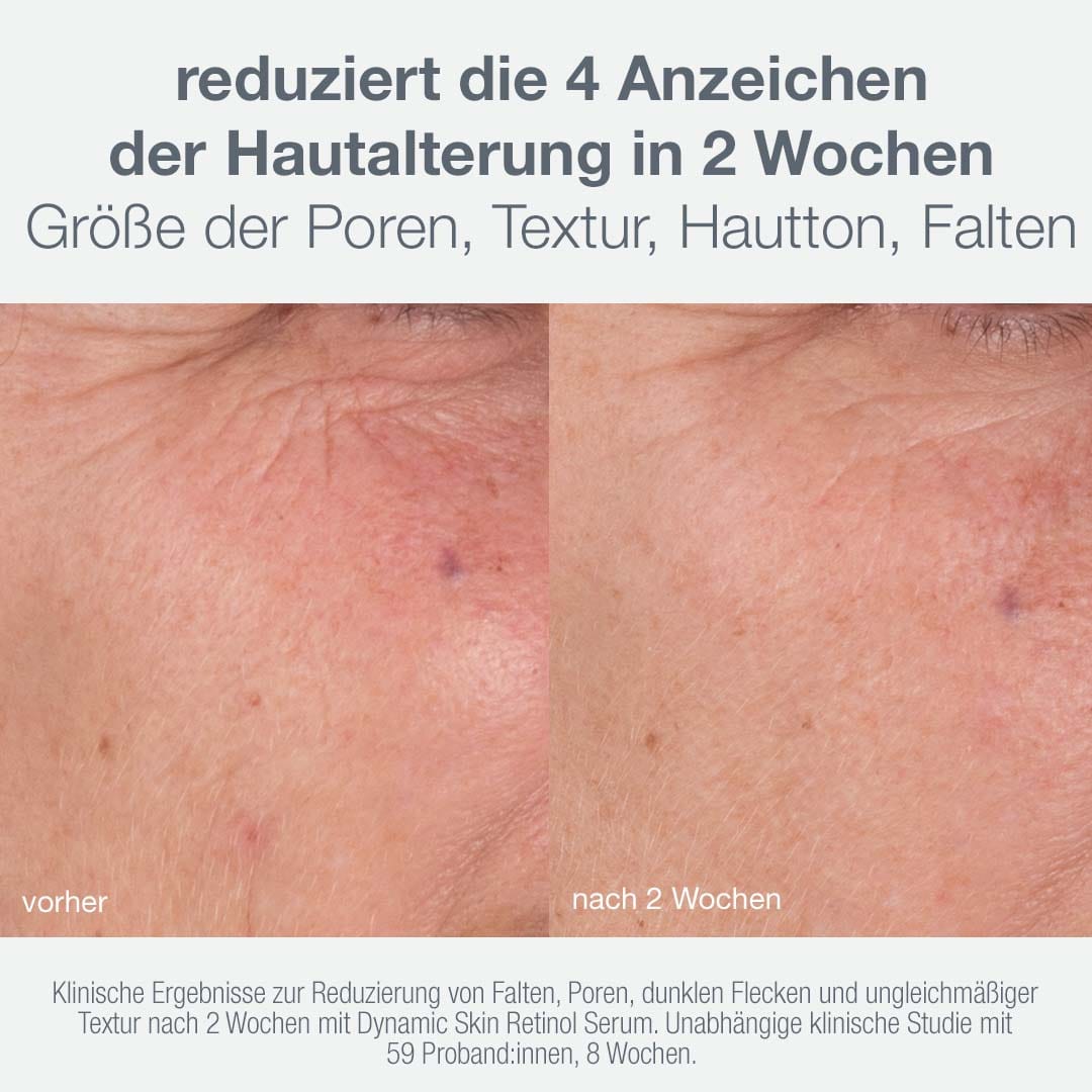 Dermalogica Skin Aging Solutions Set – Pflegeset