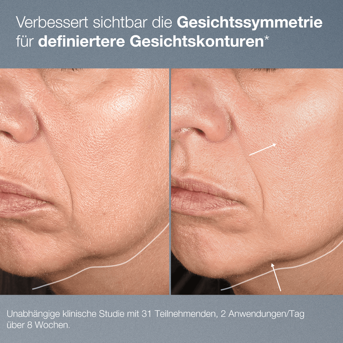 Dermalogica NeuroTouch Symmetry Serum – Serum