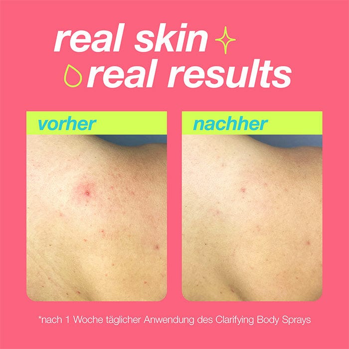 Dermalogica Clarifying Body Spray – Körperpflege