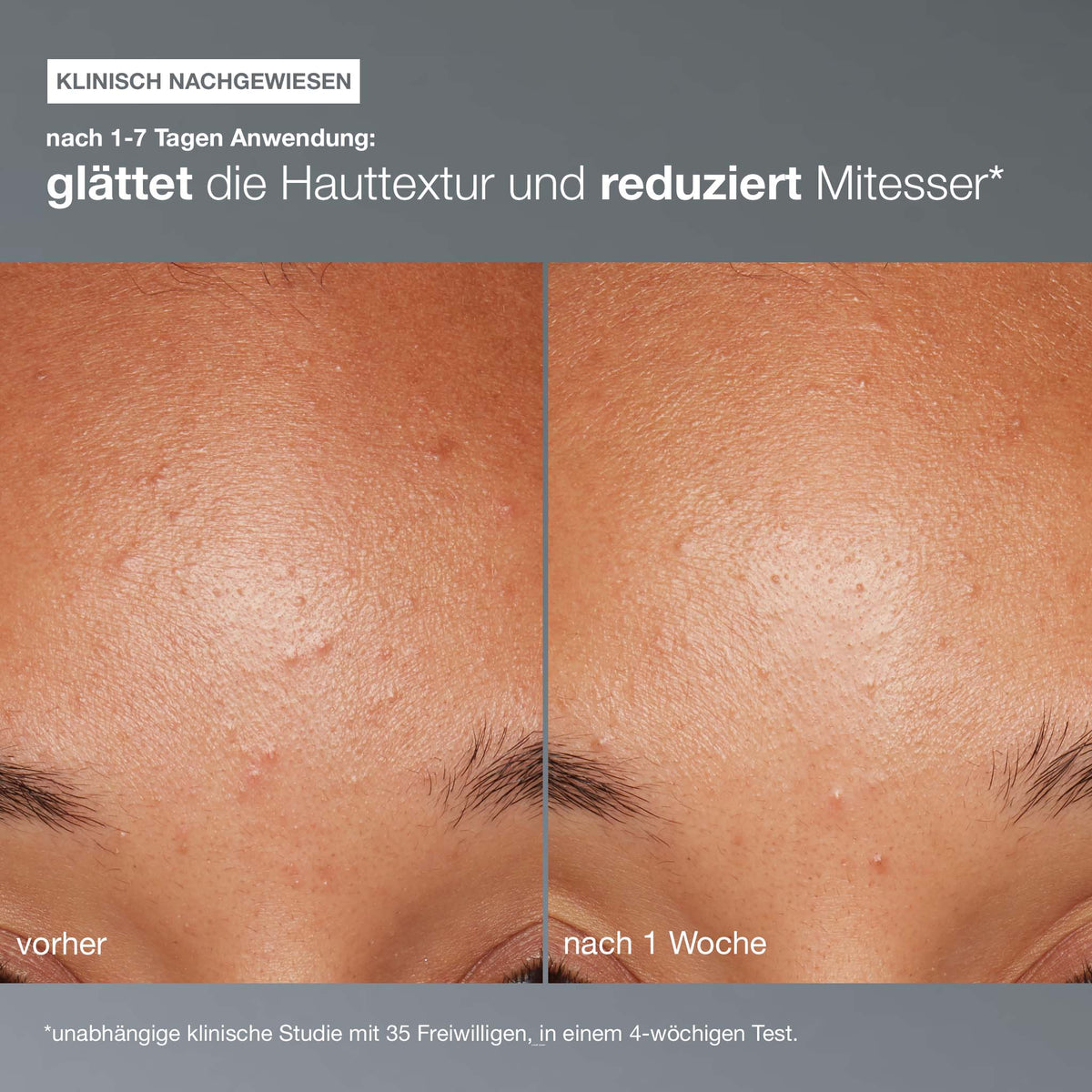 Dermalogica Daily Microfoliant – Peeling