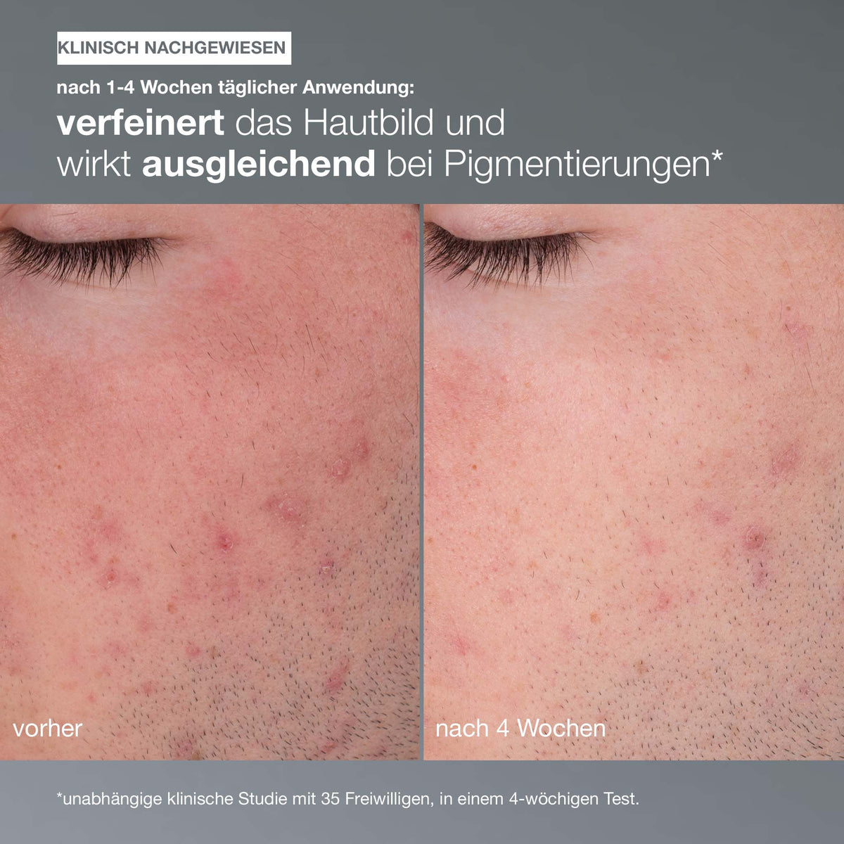 Dermalogica Daily Microfoliant + Cleansing Gel – Set