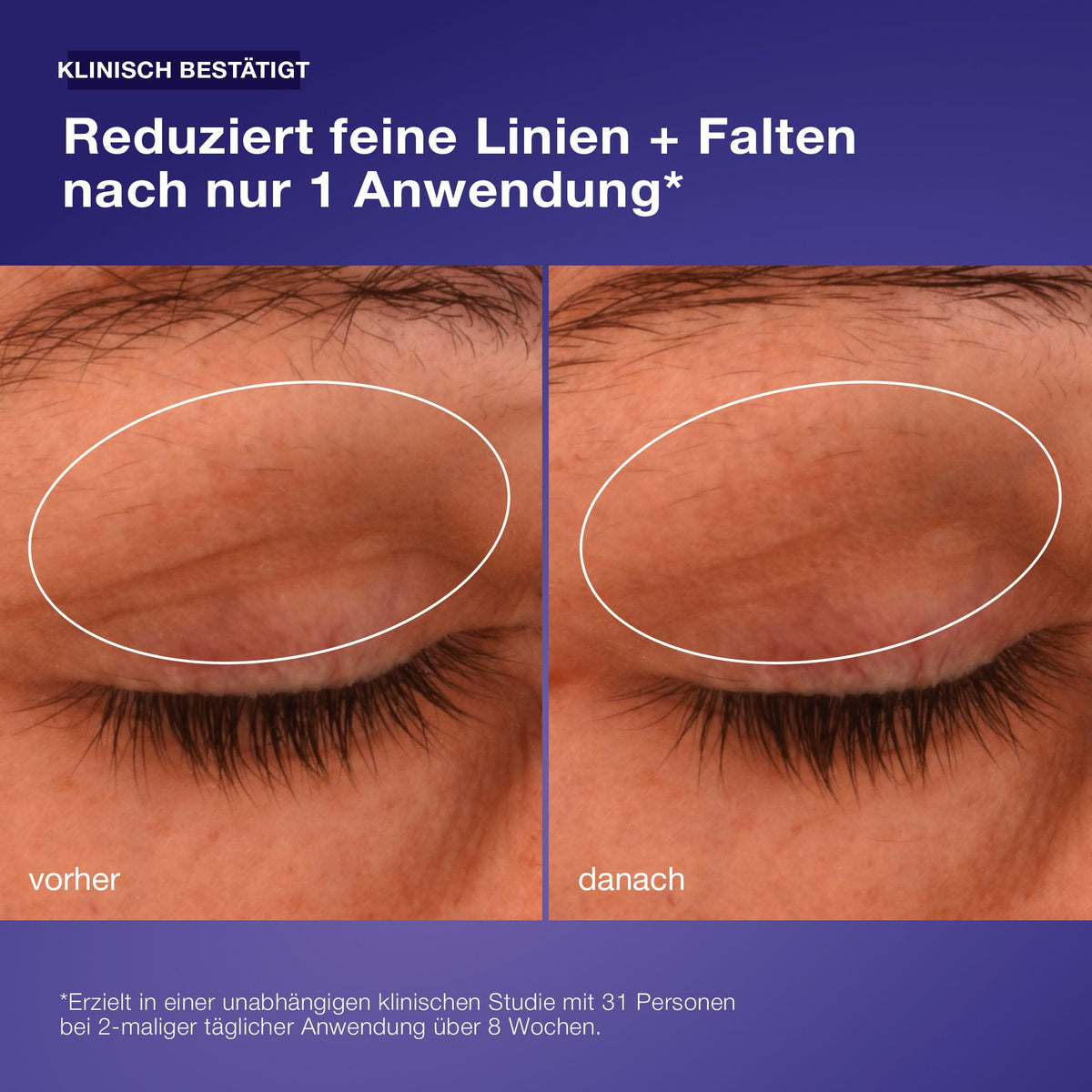 Dermalogica Phyto Nature Lifting Eye Cream – Augenpflege