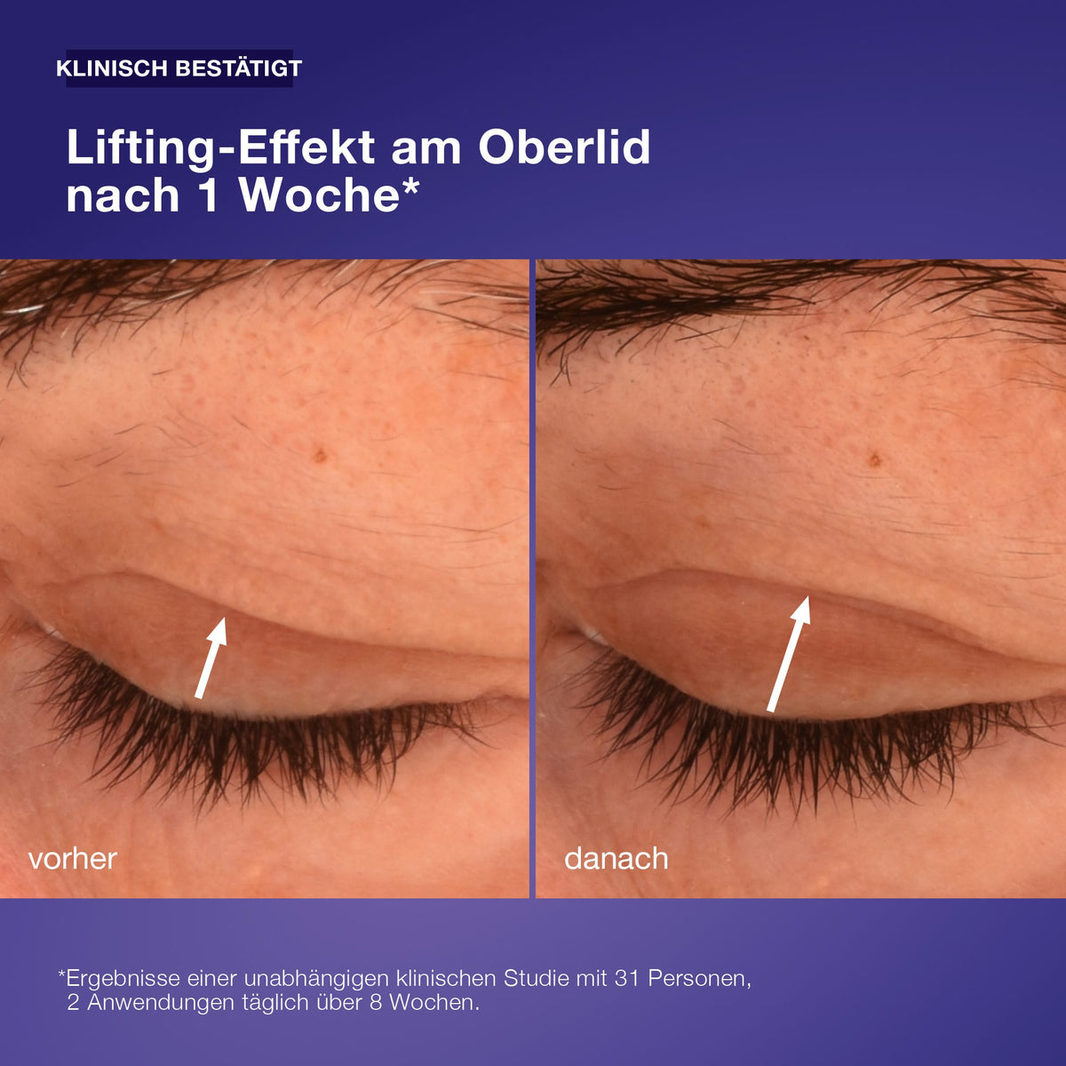Dermalogica Phyto Nature Lifting Eye Cream – Augenpflege