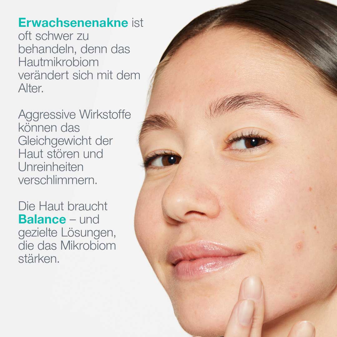 Dermalogica Breakout Biotic Moisturizer – Gesichtscreme